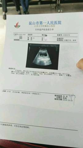 代生女孩价格夫妻挂什么科