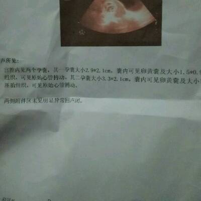以让妈妈镇江试管供卵_医院给做吗